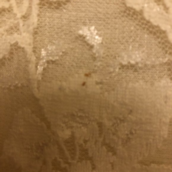 Aritzia Dillema Lace Skater Dress - Picture 8 of 16